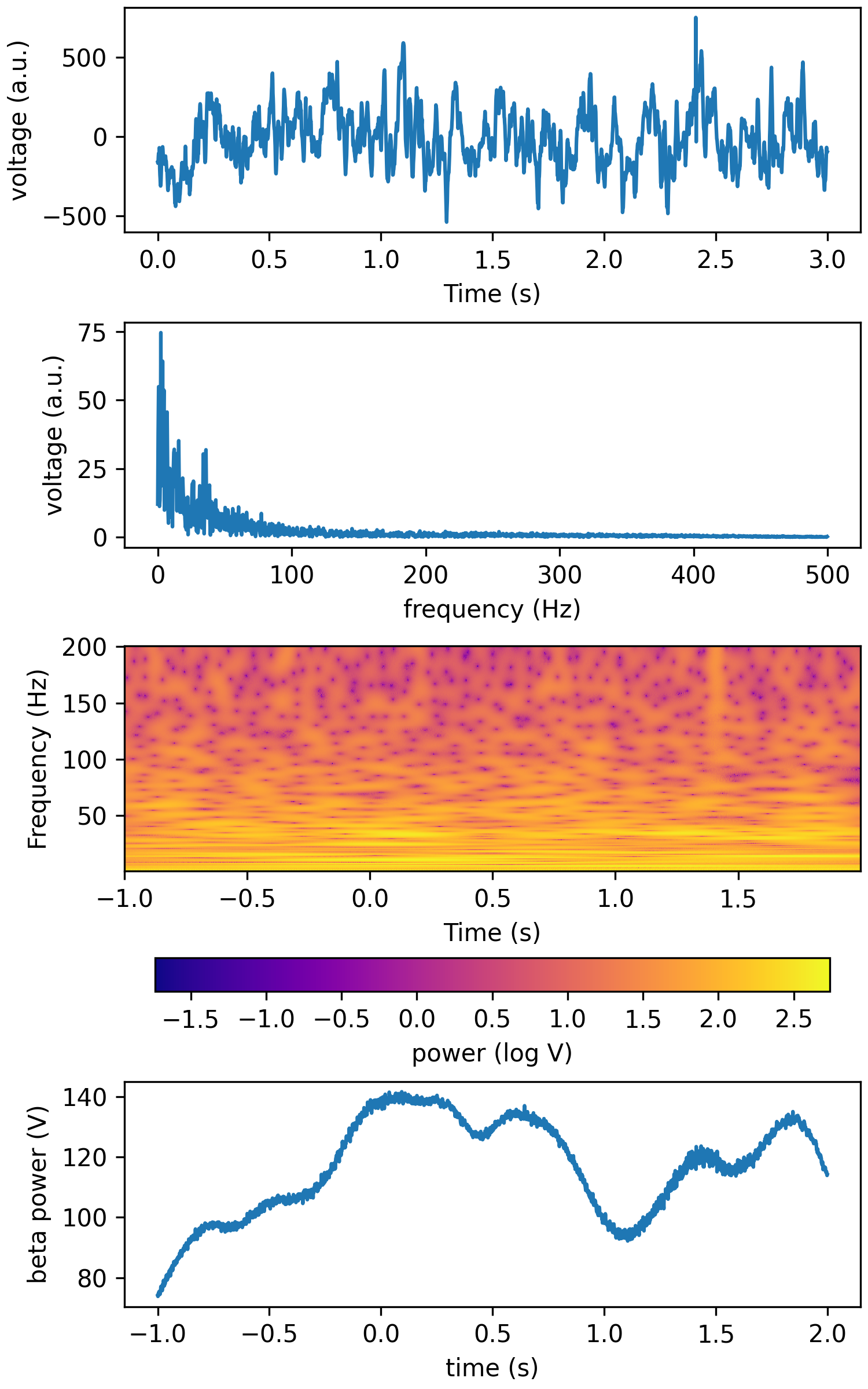 _images/tfr_cwt_lfp.png