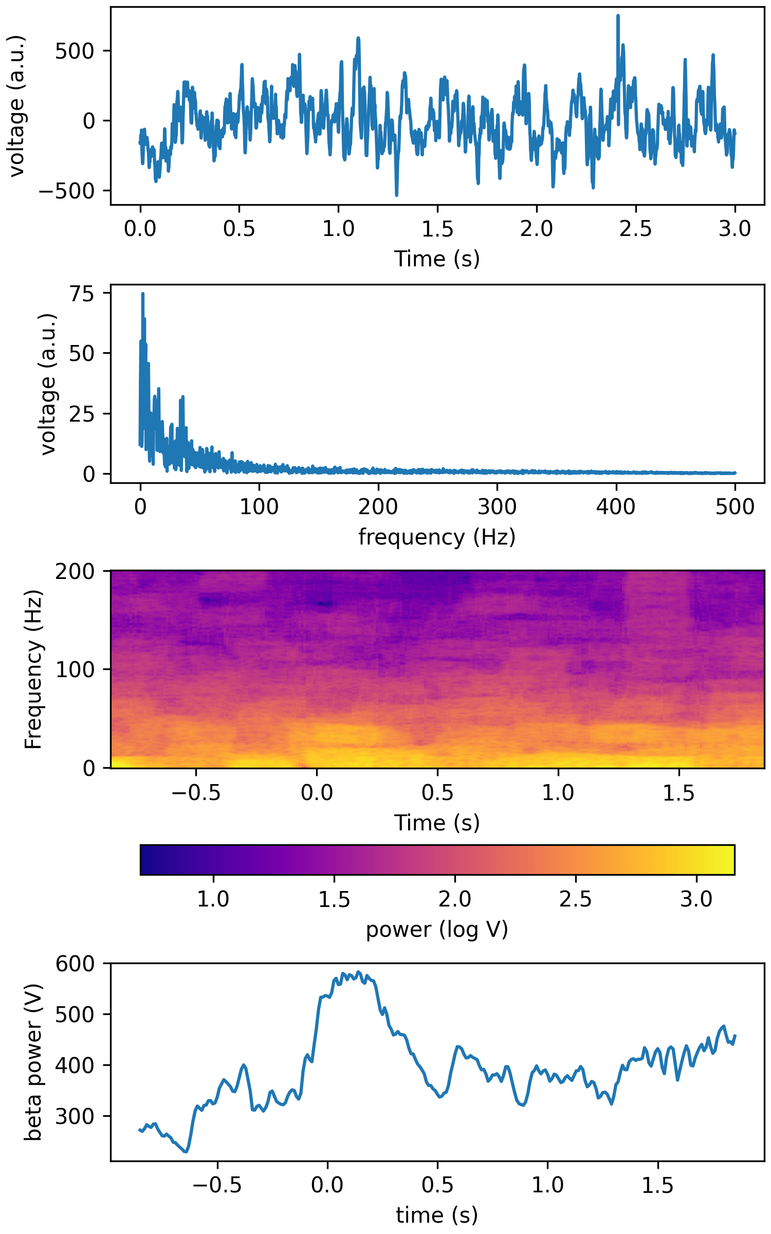 _images/tfr_mt_lfp.png