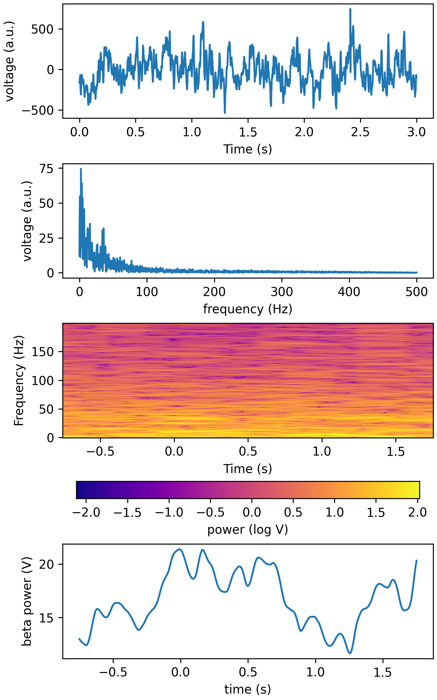 _images/tfr_ft_lfp.png