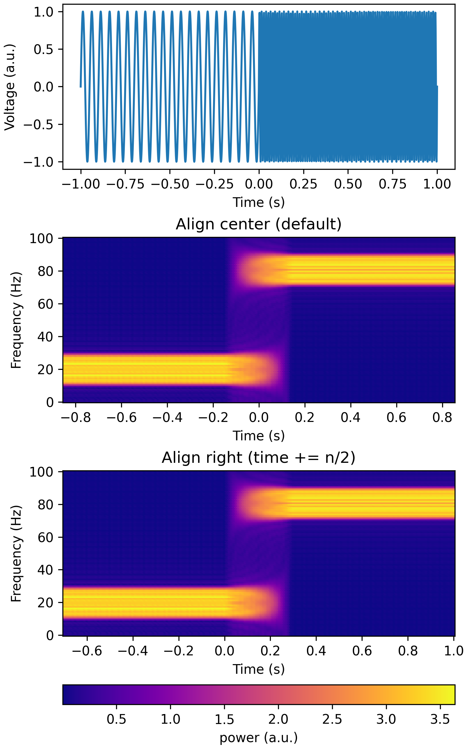 _images/tfr_mt_alignment.png