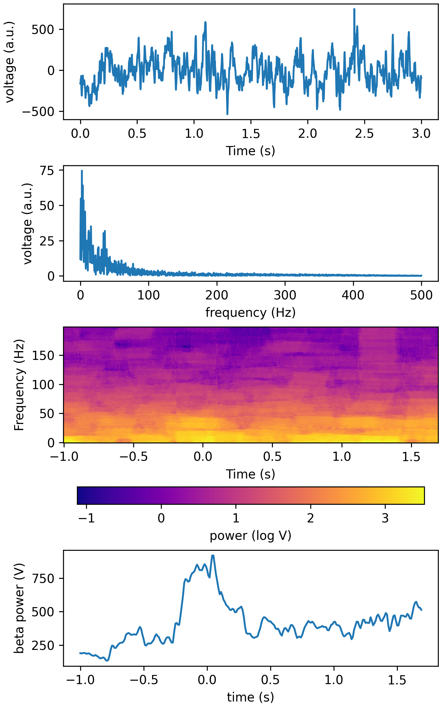 _images/tfr_mt_tsa_lfp.png